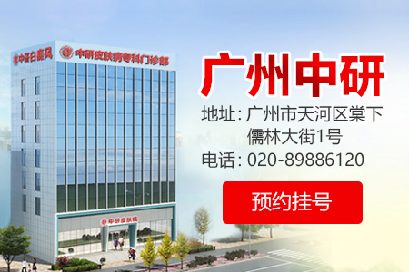 广东中研白癜风医院